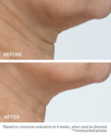 StriVectin TL Advanced Tightening Neck Cream Plus, 3.4 oz
